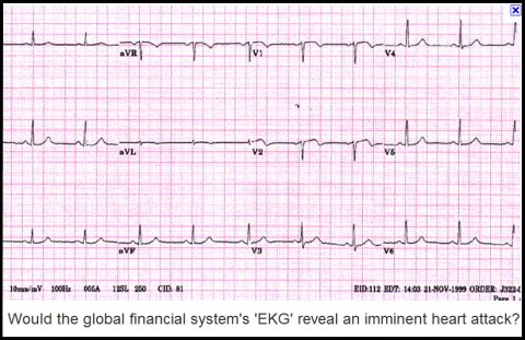 Would the global financial system's "EKG" reveal an imminent heart attack?